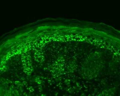 Immunohistochemistry: HSP10/EPF Antibody [NB110-11473] - Immunohistochemistry analysis using Rabbit Anti-HSP10/EPF Polyclonal Antibody (NB110-11473). Tissue: backskin. Species: Mouse. Fixation: Bouin's Fixative Solution. Primary Antibody: Rabbit Anti-HSP10/EPF Polyclonal Antibody (NB110-11473) at 1:100 for 1 hour at RT. Secondary Antibody: FITC Goat Anti-Rabbit (green) at 1:50 for 1 hour at RT. Localization: Strong basal layer punctate staining in the cytoplasm, weakens as it ascends to upper epidermis..